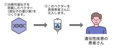 ウイルスベクターを直接体内に投与する方法