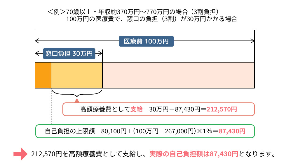 ＜例＞70歳以上・年収約370万円〜770万円の場合（3割負担）100万円の医療費で、窓口の負担（3割）が30万円かかる場合