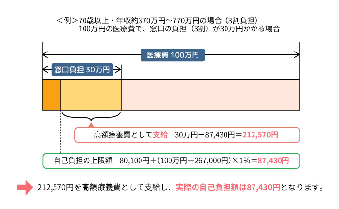 <例>70歳以上・年収約370万円〜770万円の場合(3割負担)100万円の医療費で、窓口の負担(3割)が30万円かかる場合